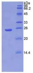 Human NPEPPS protein, His tag. GTX00222-pro