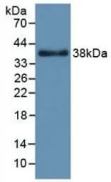 Human FGF6 protein, His and GST tag. GTX00224-pro