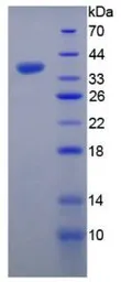 Human FGF6 protein, His and GST tag. GTX00224-pro