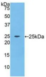 Human FGF9 protein, His tag. GTX00225-pro