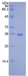 Human FGF9 protein, His tag. GTX00225-pro