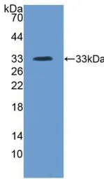 Human ITIH4 protein, His tag. GTX00226-pro