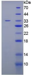 Human ITIH4 protein, His tag. GTX00226-pro