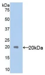 Human IL18 protein, His tag. GTX00227-pro