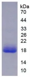 Human IL18 protein, His tag. GTX00227-pro