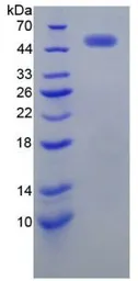 Human Her2 / ErbB2 protein, His and GST tag. GTX00232-pro