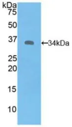 Human Syk protein, His tag. GTX00233-pro