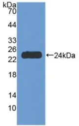 Human TNF Receptor I protein, His tag. GTX00236-pro
