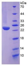 Human TNF Receptor I protein, His tag. GTX00236-pro