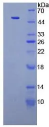 Human PKM protein, His and GST tag. GTX00238-pro