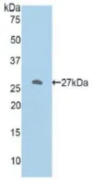 Human ODC protein, His tag. GTX00240-pro
