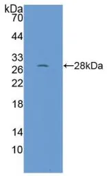 Human RPP40 protein, His tag. GTX00241-pro