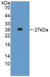 Human FGF19 protein, His tag. GTX00243-pro