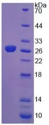 Human FGF19 protein, His tag. GTX00243-pro