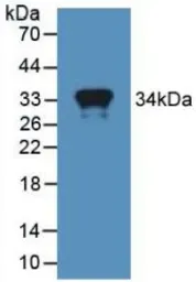 Human MX1 protein, His tag. GTX00244-pro