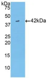 Human Creatine kinase (brain) protein, His tag. GTX00246-pro