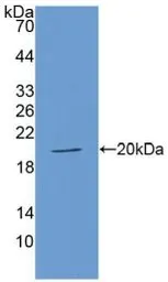 Human ACE protein, His tag. GTX00247-pro