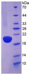 Human ACE protein, His tag. GTX00247-pro