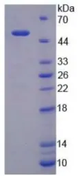 Human LBP protein, His tag. GTX00248-pro