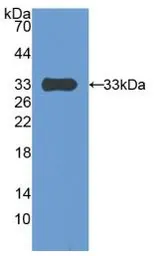 Human PAPP A protein, His tag. GTX00255-pro