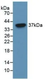Human PAPP A protein, His tag. GTX00256-pro