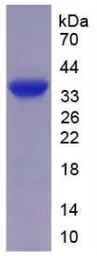 Human PAPP A protein, His tag. GTX00256-pro