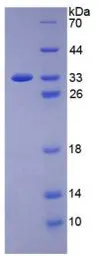 Human VEGF Receptor 2 protein, His tag (active). GTX00258-pro