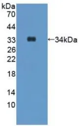 Human Hepcidin protein, His and Human IgG1 Fc tag. GTX00261-pro