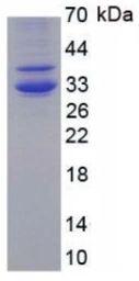 Human Hepcidin protein, His and Human IgG1 Fc tag. GTX00261-pro