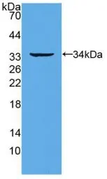 Human RANK protein, His tag. GTX00262-pro