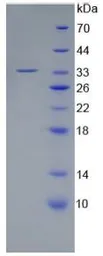 Human RANK protein, His tag. GTX00262-pro