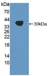 Human LPA protein, His tag. GTX00272-pro
