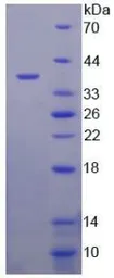 Human LPA protein, His tag. GTX00272-pro