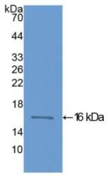 Human FABP3 protein, His tag. GTX00275-pro