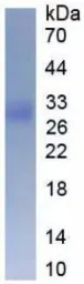 Human SOD3 protein, His tag. GTX00276-pro