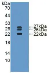 Human IL1 Receptor antagonist protein, His tag. GTX00277-pro