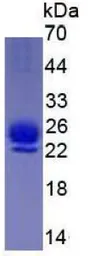 Human IL1 Receptor antagonist protein, His tag. GTX00277-pro