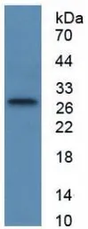 Human TFPI2 protein, His tag (active). GTX00278-pro
