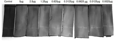 Human TFPI2 protein, His tag (active). GTX00278-pro