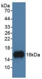 Human UGCG protein, His tag. GTX00280-pro