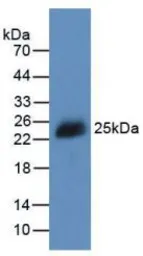 Mouse IL2 protein, His tag (active). GTX00285-pro