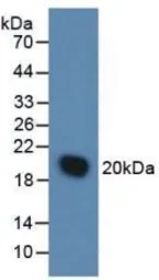 Mouse IL1 Receptor antagonist protein, His tag. GTX00289-pro