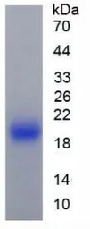 Mouse IL1 Receptor antagonist protein, His tag. GTX00289-pro