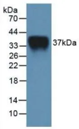 Mouse IL2 Receptor alpha protein, His tag. GTX00298-pro