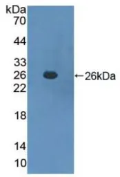 Mouse SOCS3 protein, His tag. GTX00304-pro
