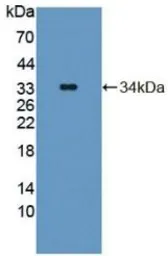 Mouse Tyrosine Aminotransferase protein, His tag. GTX00309-pro