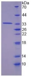Mouse Tyrosine Aminotransferase protein, His tag. GTX00309-pro