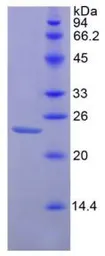 Mouse CD47 protein, His tag. GTX00311-pro