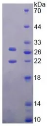 Mouse TIMP3 protein, His tag. GTX00324-pro