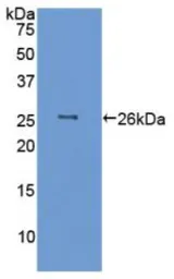 Pig IL6 protein, His tag (active). GTX00338-pro